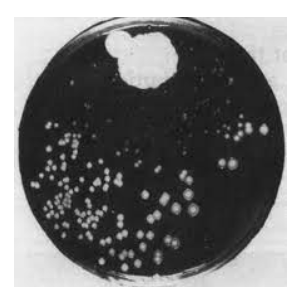 Fleming and the Discovery of Penicillin